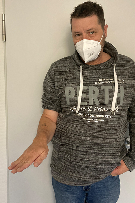Bild Essex Lopresti Lerletzung Patient streckt die Hand aus