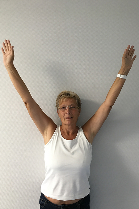 Bild von Oberarmkopfnekrose Patienten macht eine Armstreckung nach Hemiprothese