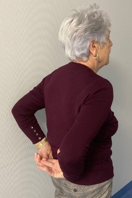 Bild Schulterprothese Patientin nach 4 Monaten