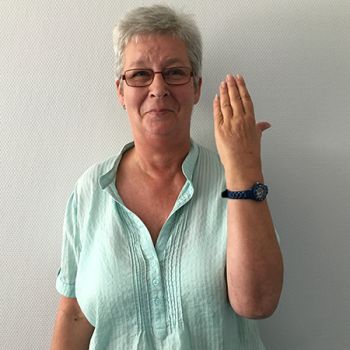 Bild Patientin zeigt ihre Hand Processus Coronoideus Fraktur
